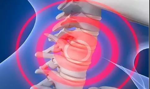 手麻需要重视吗,手麻腿麻别忽视