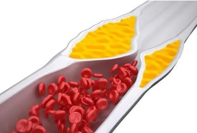 长期吃核桃对人身体有什么好处,经常吃核桃对身体有什么好处