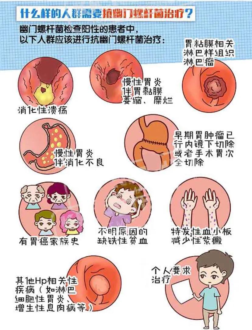 16岁孩子幽门螺杆菌阳性要治疗吗,幽门螺杆菌阳性dpm205严重吗