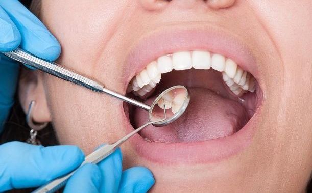 茴香有什么副作用,茴香营养价值禁忌