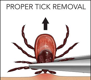 野外游玩谨防蜱叮咬,出门游玩怎么预防蜱虫叮咬