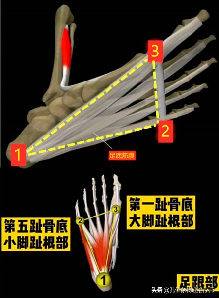 如何治疗足底筋膜炎缓解疼痛,足跟痛筋膜炎最佳的治疗办法