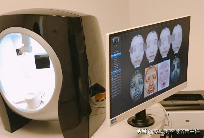 visia皮肤检测仪,visia皮肤检测报告数值越大越好吗