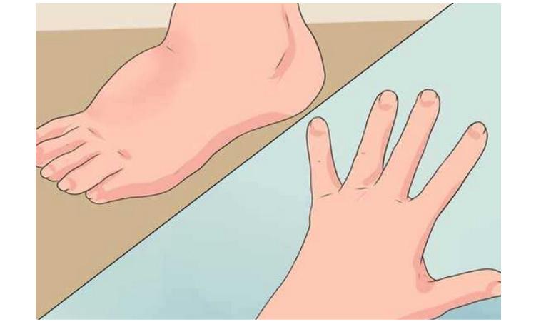 心肌营养不良症状及表现,孕期营养不良有哪些表现