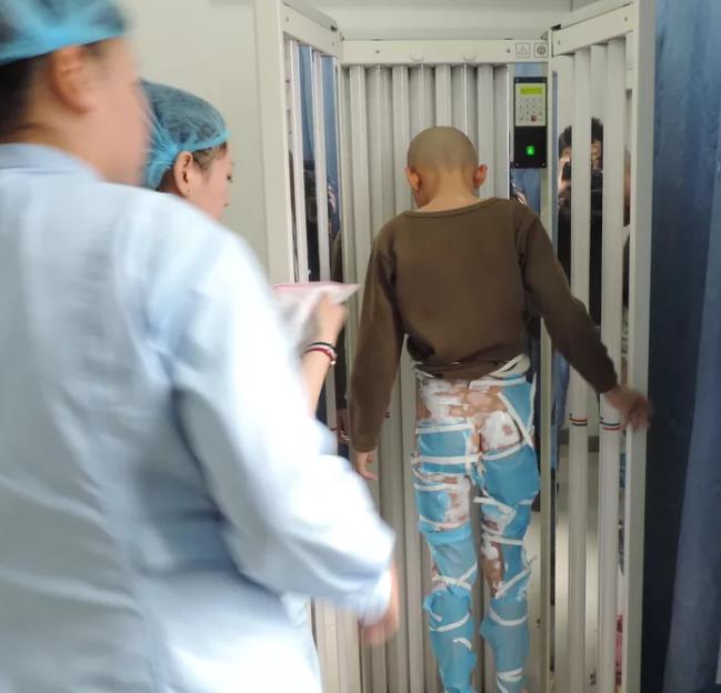 紫外线治疗白癜风会发黑发红吗,白癜风患者怎样预防紫外线