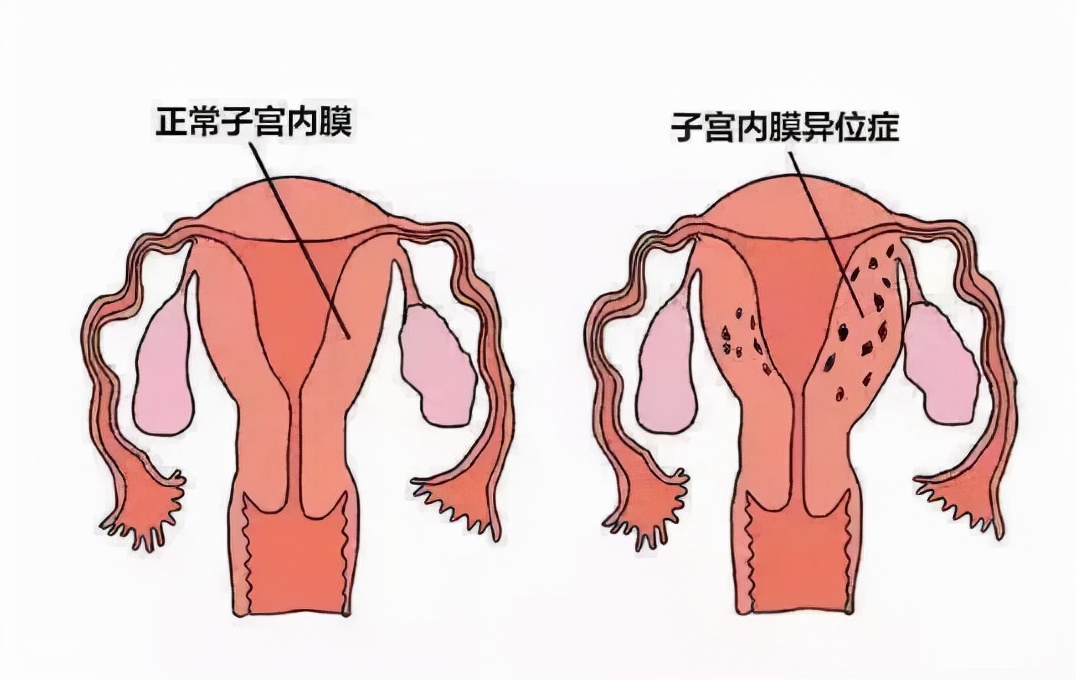第一次着床失败怎么恢复,第一次胚胎失败又要多久才能移植