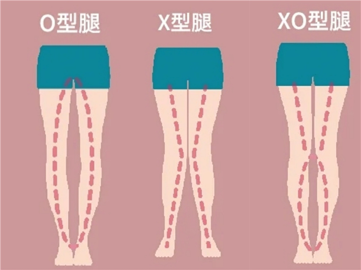 不同脚型适合的鞋子,鞋子不一定要贵只要合脚就行