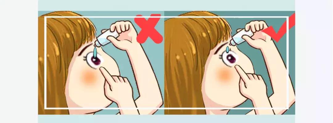 加拿大禁售日本眼药水,日本参天眼药水为什么禁售