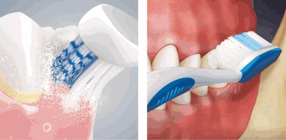 去除牙齿黄垢的神器,牙齿变白除口臭神器