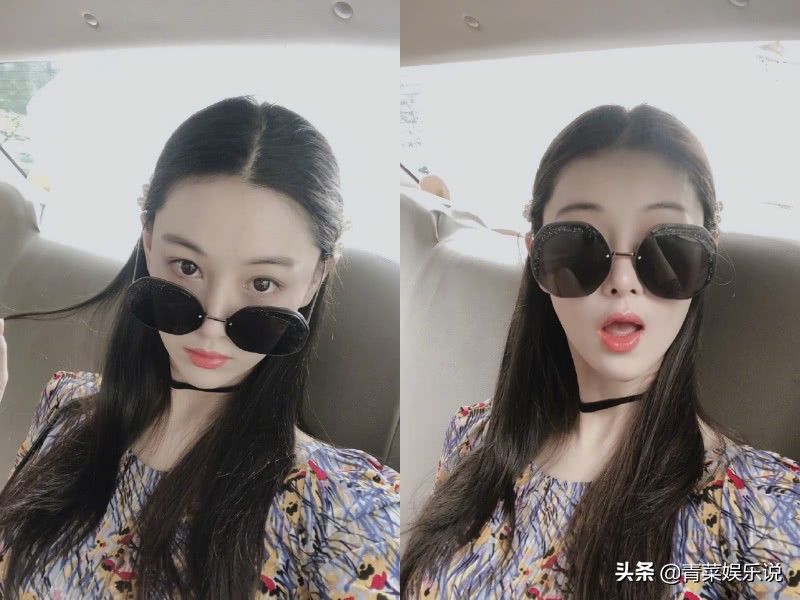 张馨予拍戏遭遇“低温烫伤”,张馨予晒受伤照片