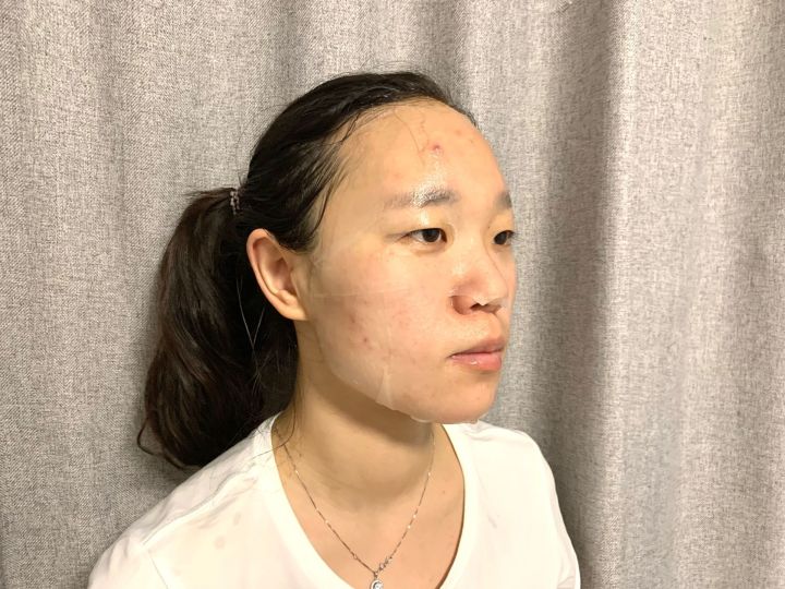 医用冷敷贴物理降温,医用冷敷贴面膜有补水效果吗