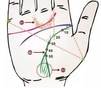 掌纹诊病图片,掌纹能查出糖尿病吗