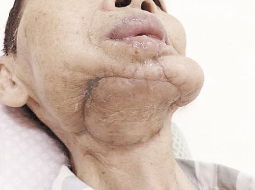 槟榔软性毒品什么意思,软性毒药槟榔