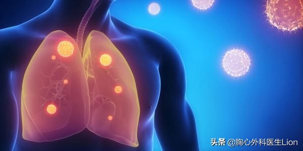 肺癌怎么检测早期或是晚期,肺癌晚期和早期的检测方法