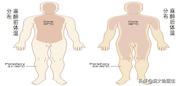 手术麻醉后颤抖是怎么回事？