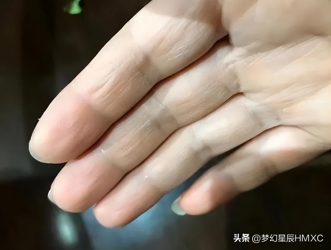 如何让脸白嫩小妙招,如何快速让手脸变得白嫩