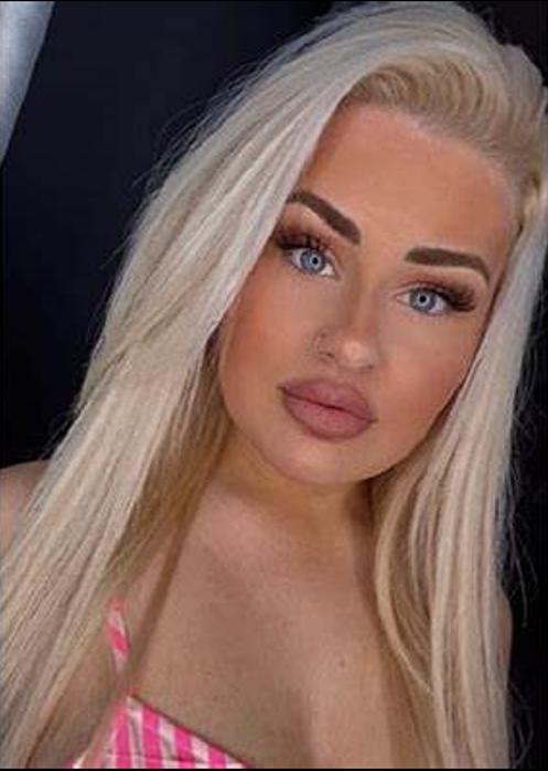 丰唇失败变成香肠嘴,丰唇手术后变成香肠嘴