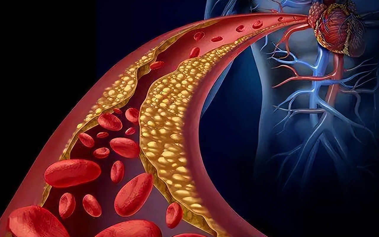 过敏性紫癜会越来越严重吗,过敏性紫癜伴随腿疼严重吗