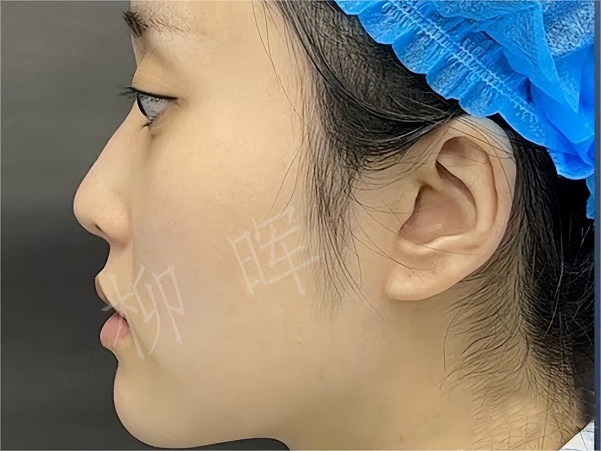 塌鼻子侧脸怎么变成高鼻梁p图,侧脸扁平没有立体感怎么拍照