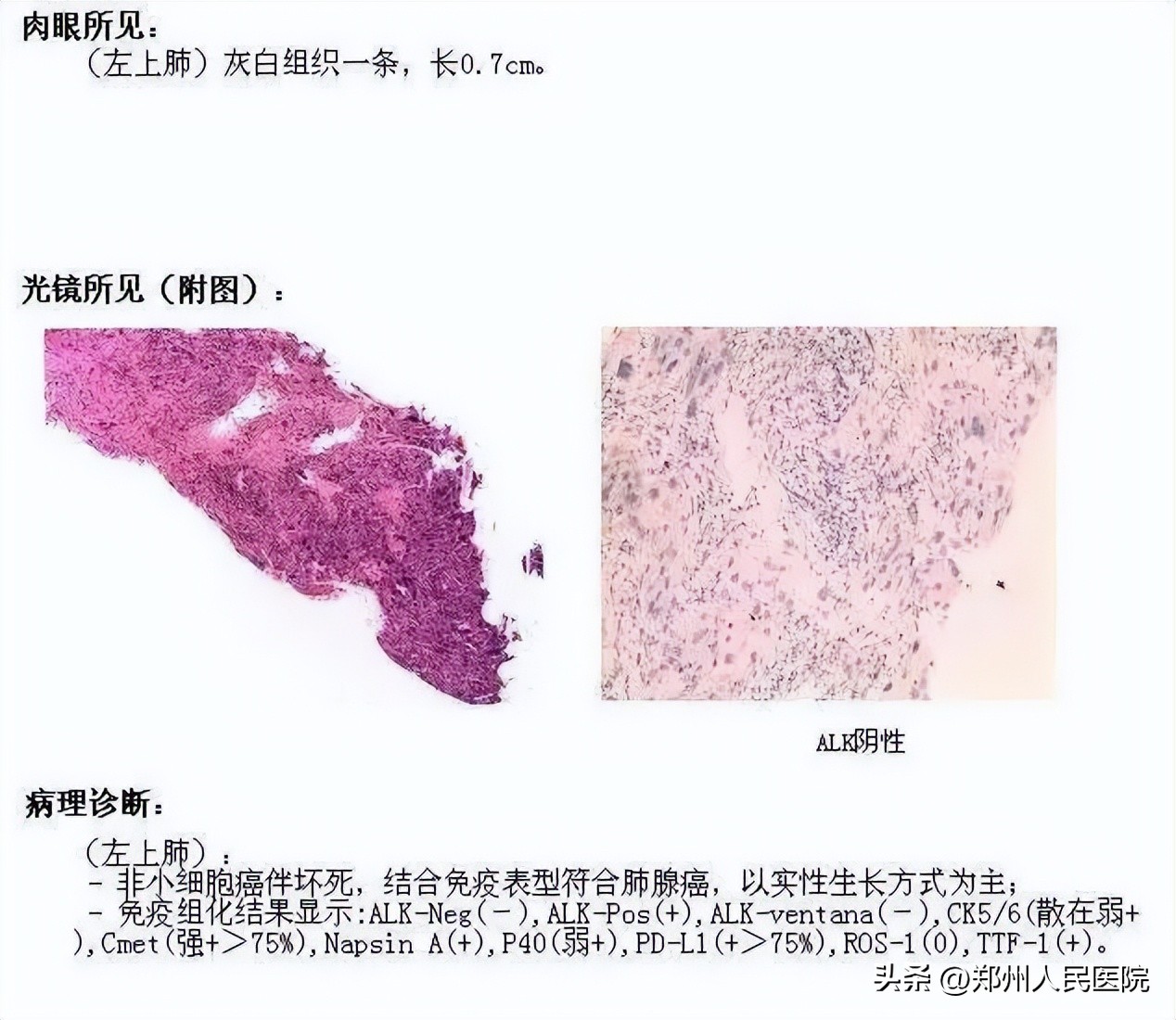 切片？捞片？烤片？听着你像在做菜，你却说在“破案”！