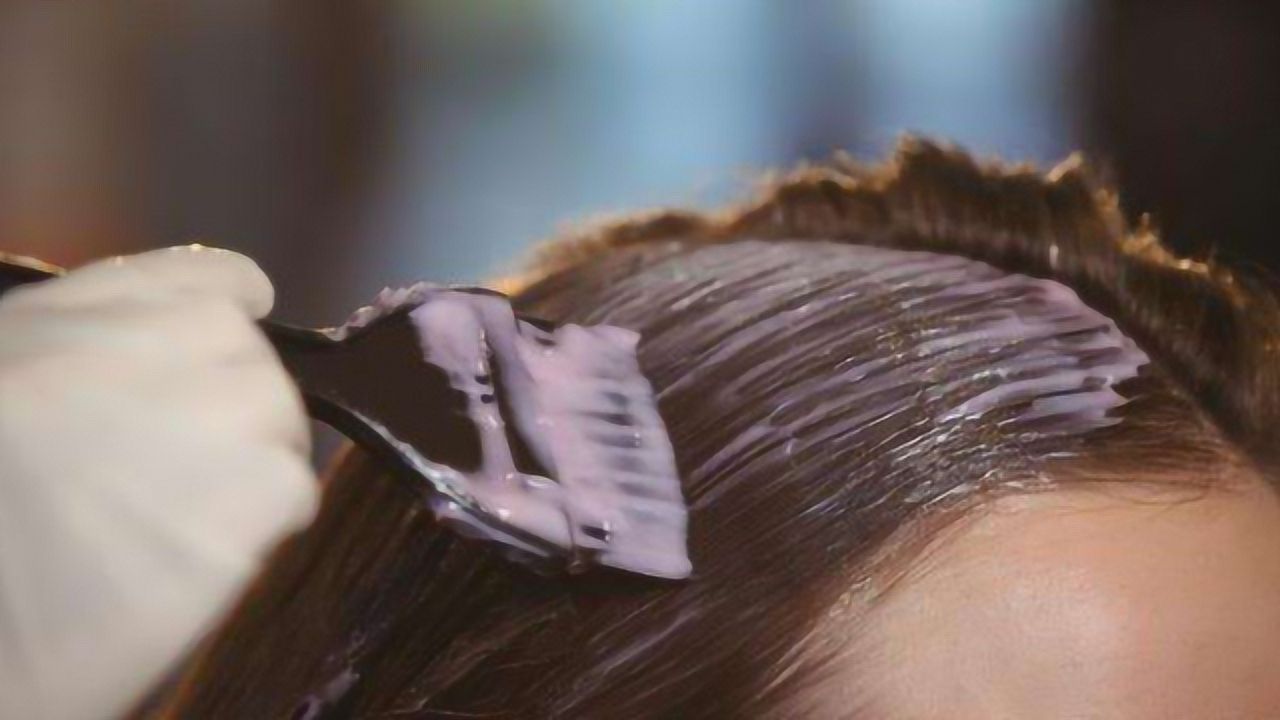 头痒头屑多掉发严重小妙招,治疗头屑头痒脱发的小妙招