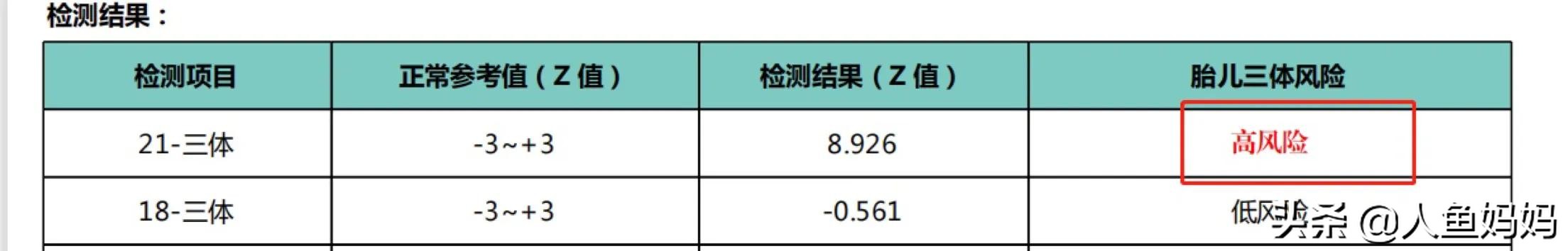 孕妇双胞胎做羊膜穿刺,怀双胞胎产检全过程