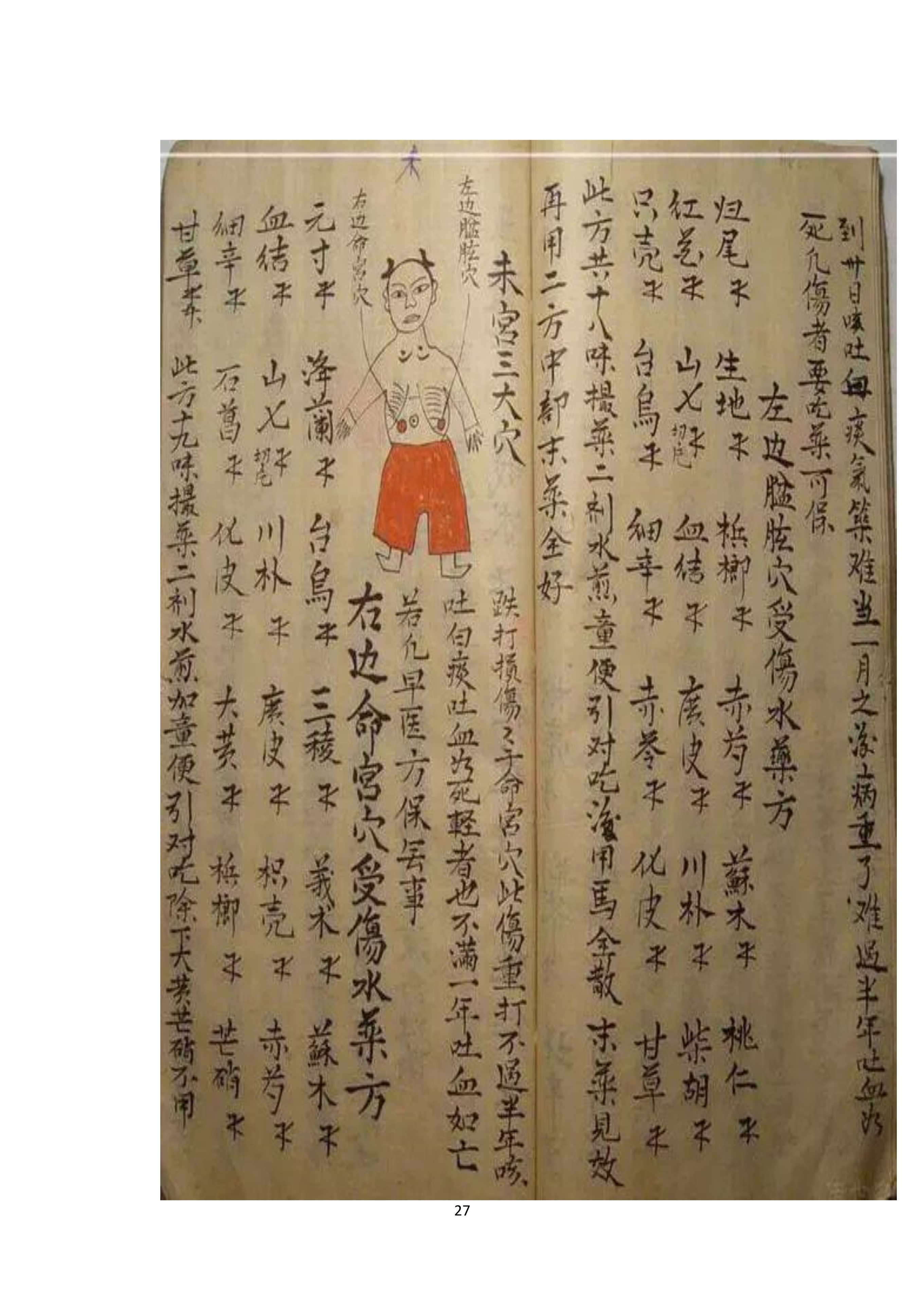 中医古书籍清代带图且内容非常好的手抄跌打损伤良方