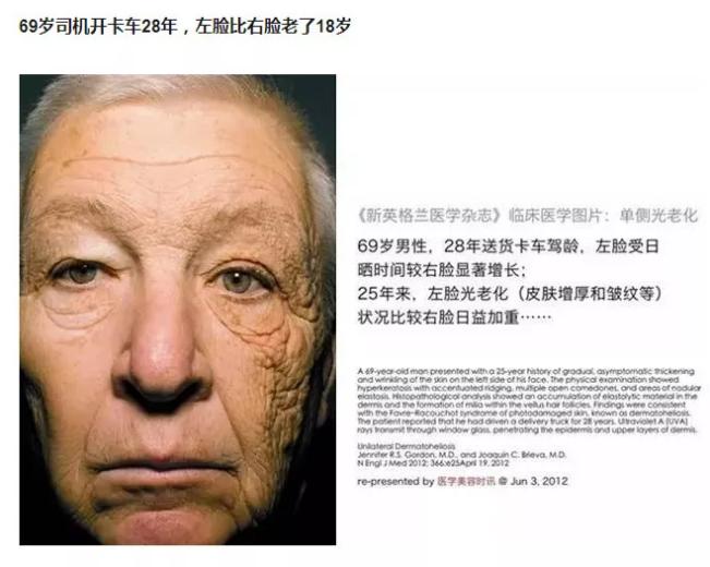 澳洲伊肤姿防晒 (一款全光谱抗衰老防晒霜)