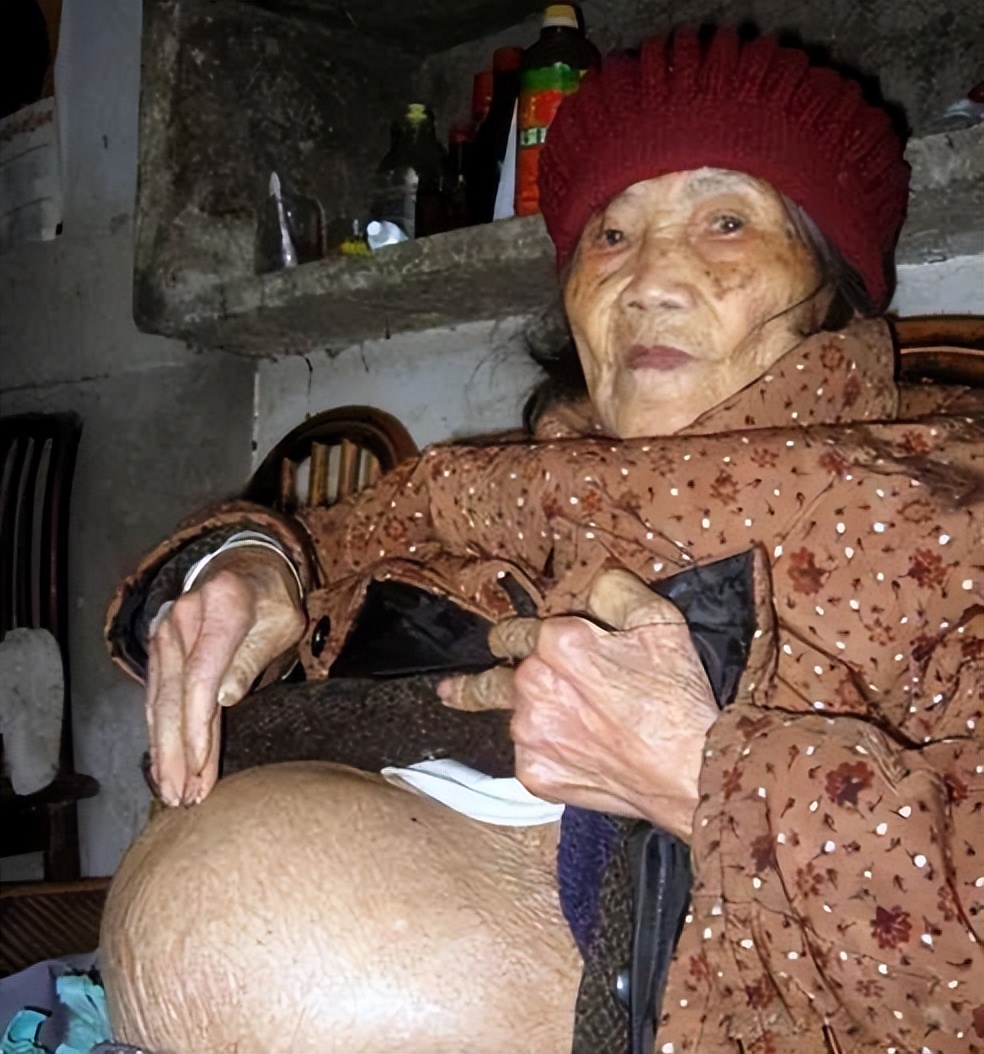 七旬老太意外怀孕新闻,67岁老太意外怀孕