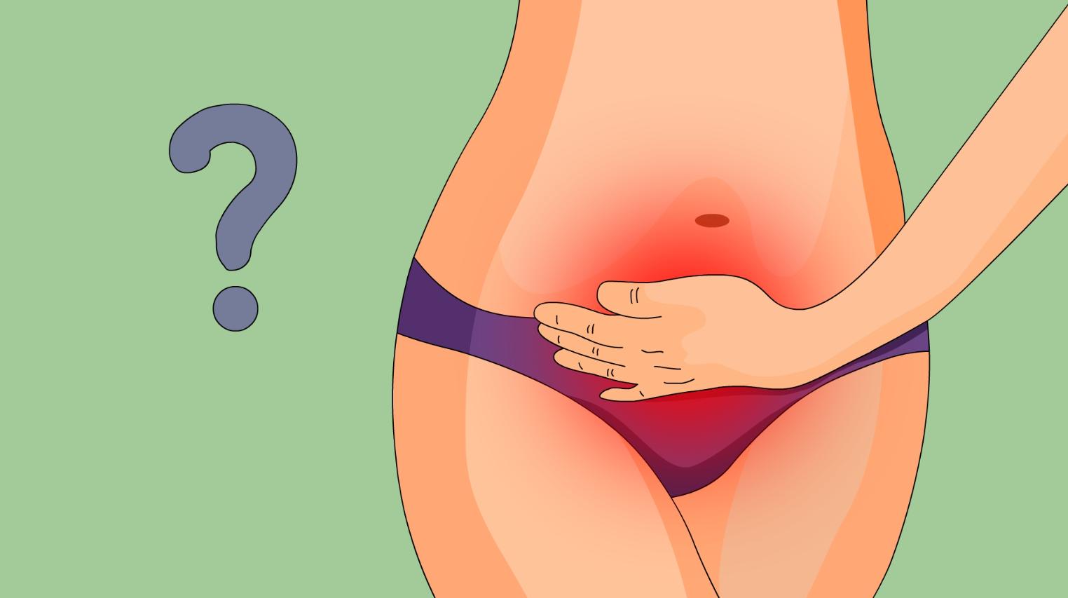 慢性盆腔炎寒湿瘀滞吃什么中成药,治疗慢性盆腔炎的中药伤胃吗