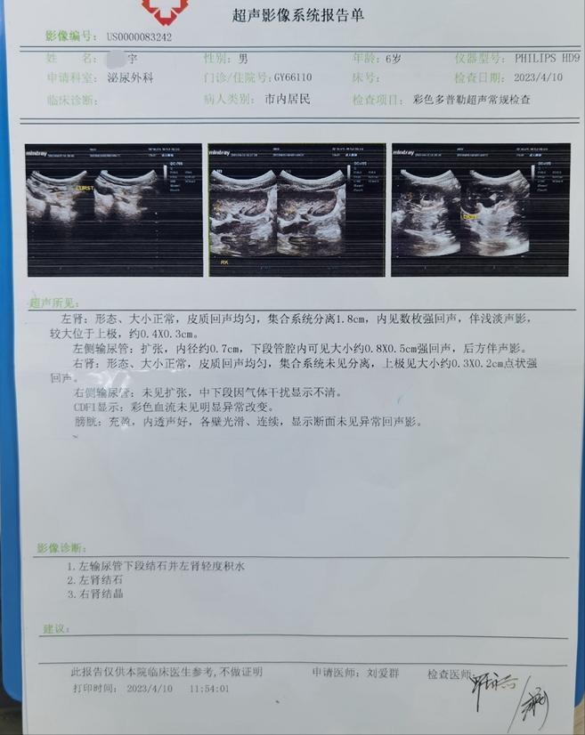 6岁娃遭遇结石嵌顿父母及时送医化解积水危机