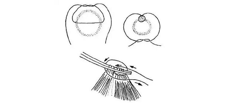 外科缝合技巧你熟练吗,外科缝合术的操作步骤