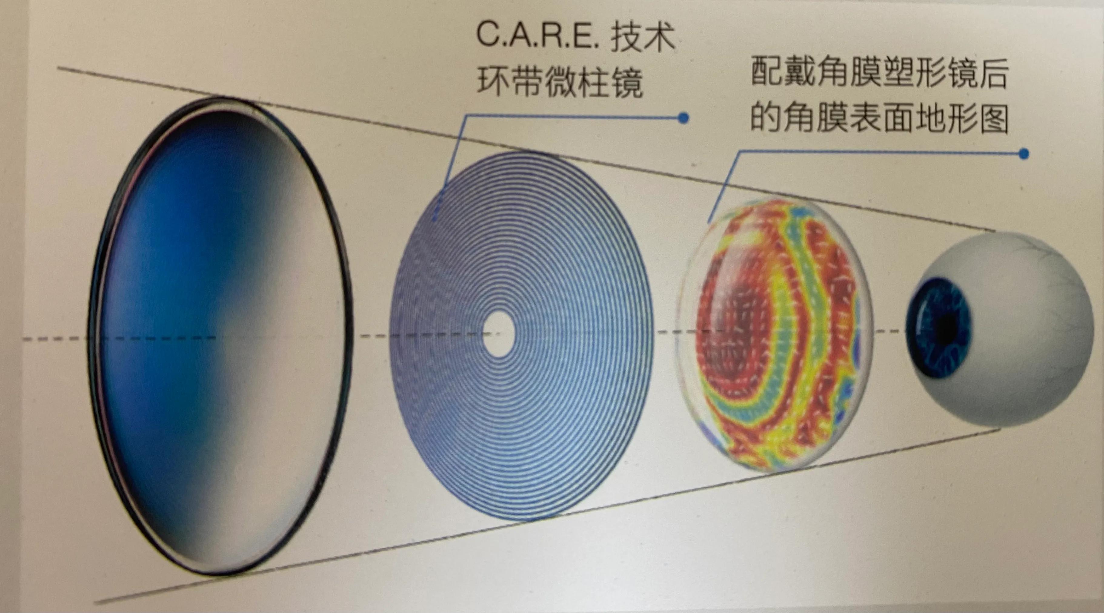 豪雅新乐学与依视路星趣控的区别,豪雅新乐学与依视路星趣控差别