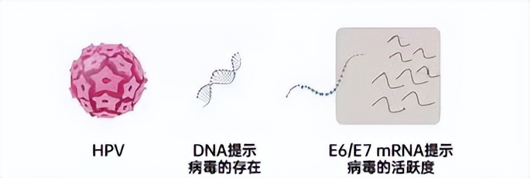 HPV感染之后还要查什么,hpv感染不可怕可预防可调理