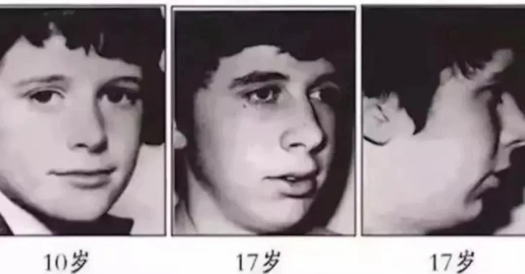 杨颖凸嘴分析,显老显凶嘴凸