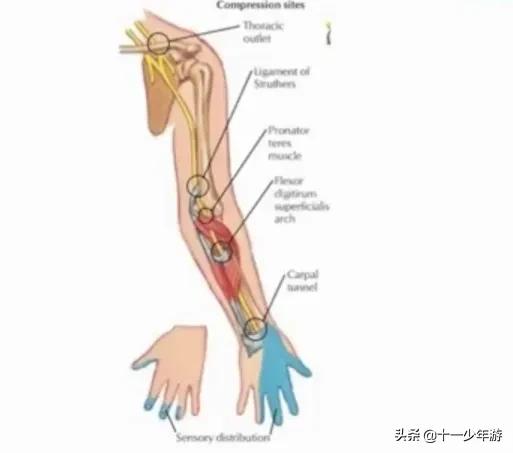 周围神经病和外周神经病,周围神经病