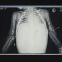 韩国女童被虐待致死,韩国女孩被虐待案结局