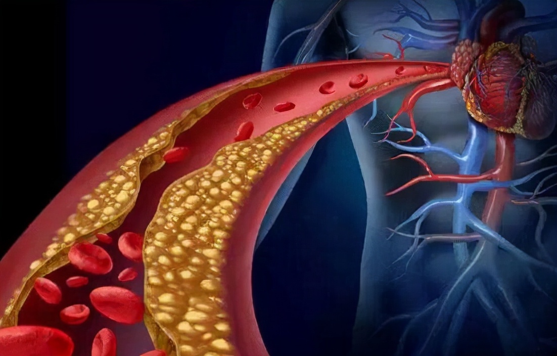 飞行员体检血压高会停飞吗,飞行员得了甲减能停飞吗
