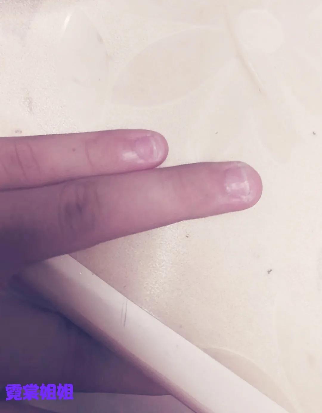 一招治好孩子爱啃指甲的毛病