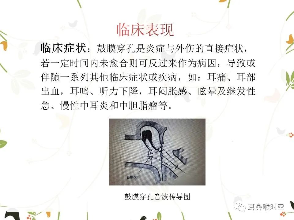 鼓膜可见穿孔,鼓膜穿孔听力下降能恢复吗