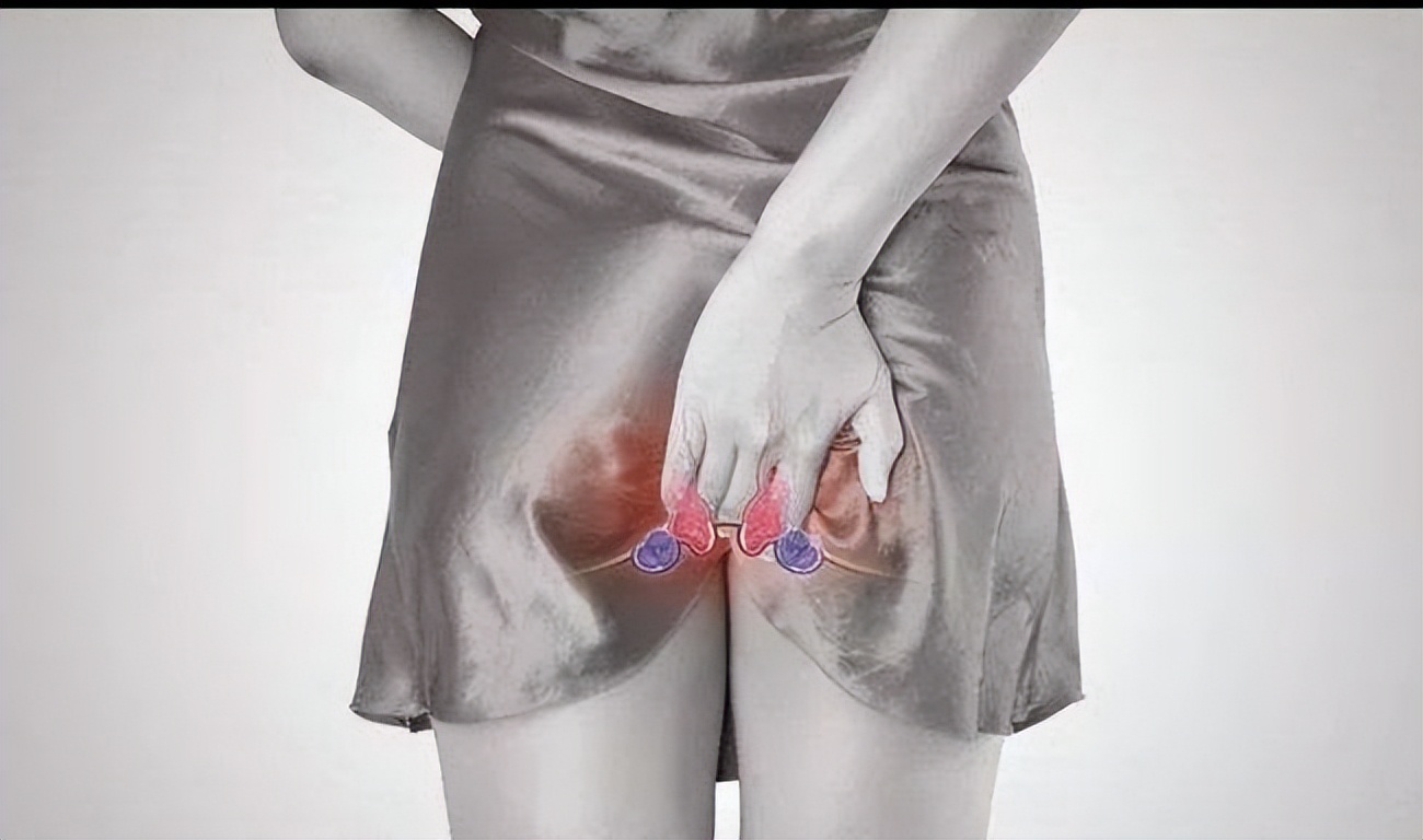 痔疮蹲不下去怎么回事,痔疮坐不住怎么缓解