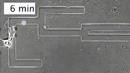 运动神经元显微镜观察内容与结果,显微镜下观察神经元的判断依据