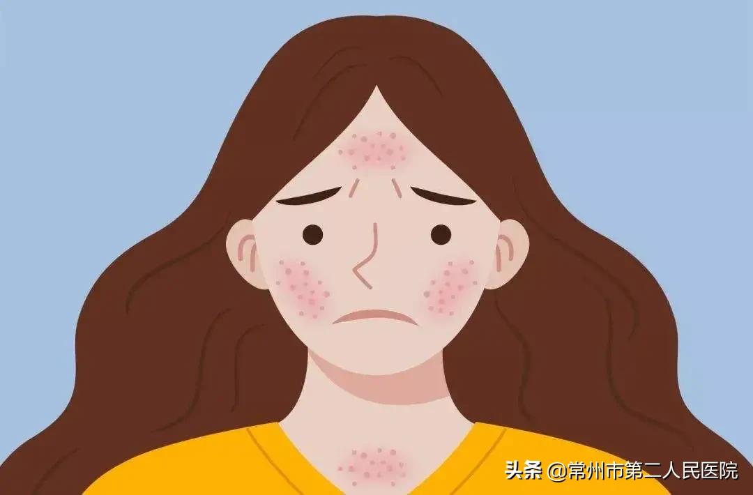 手脚发痒难受长红疙瘩特别是晚上,一到晚上手脚就痒用什么药