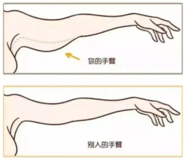 吸脂瘦手臂的效果怎么样呢,吸脂瘦手臂有什么危害吗