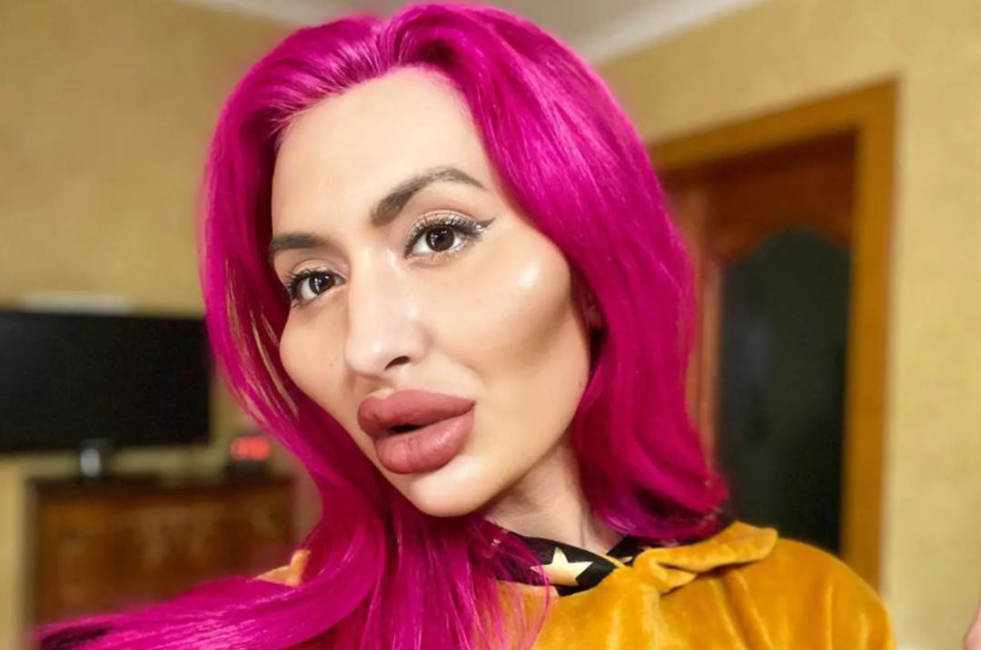 这个动手术打造世界最高颧骨的女人，再次向自己的颧骨下手了