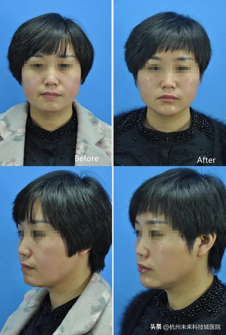 不追求一个模板的复制美|17年专注年轻化专家