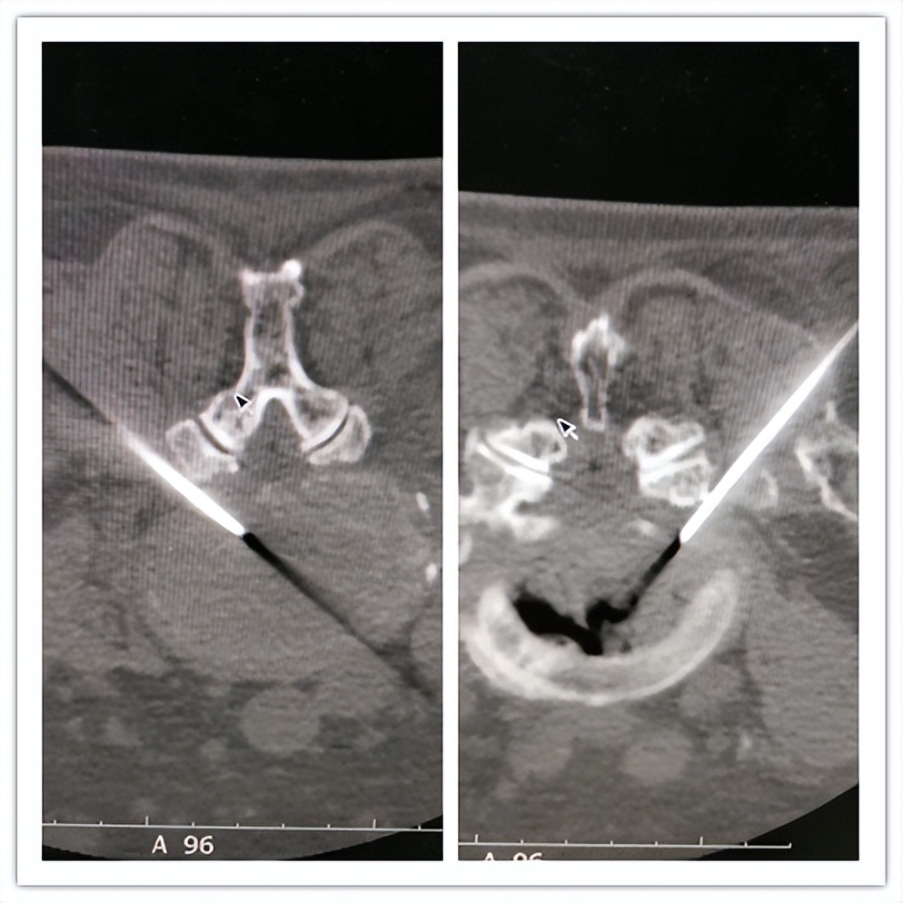 嘉善人民医院疼痛科专家,嘉善第一人民医院中医内科