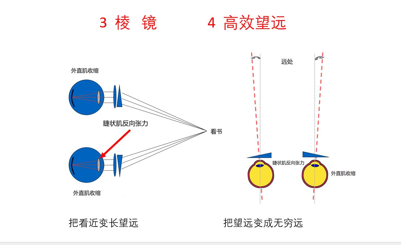 孩子近视最好的解决方案,孩子近视200多度到底怎么治疗好