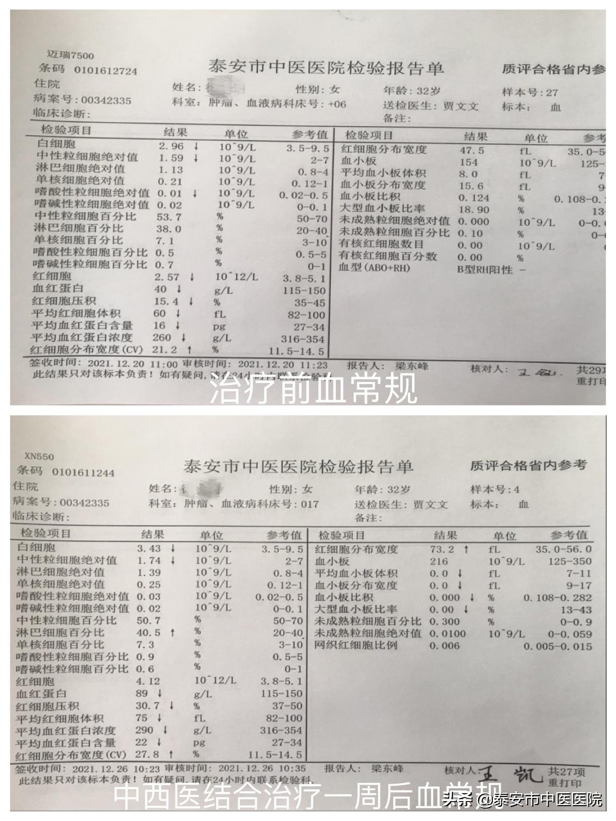 北京专家治疗贫血方法,贫血中医经方