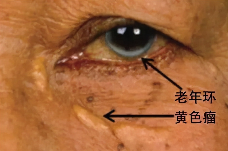 五种身体异常信号预示的疾病,身体出现哪些症状预示要就医